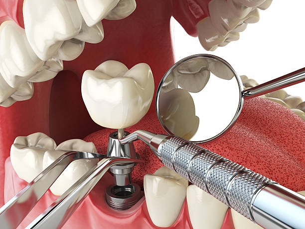 Best Urgent Tooth Repair  in Firebaugh, CA