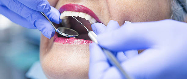 Urgent Tooth Repair in CA